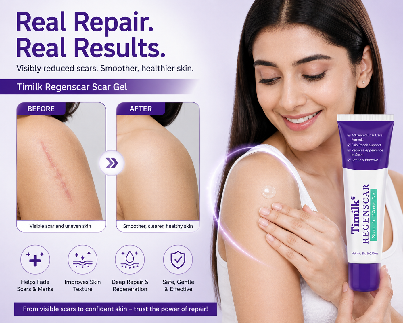 TiMilk – ReGen Scar Stem Cell Repair Gel