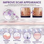 TiMilk – ReGen Scar Stem Cell Repair Gel