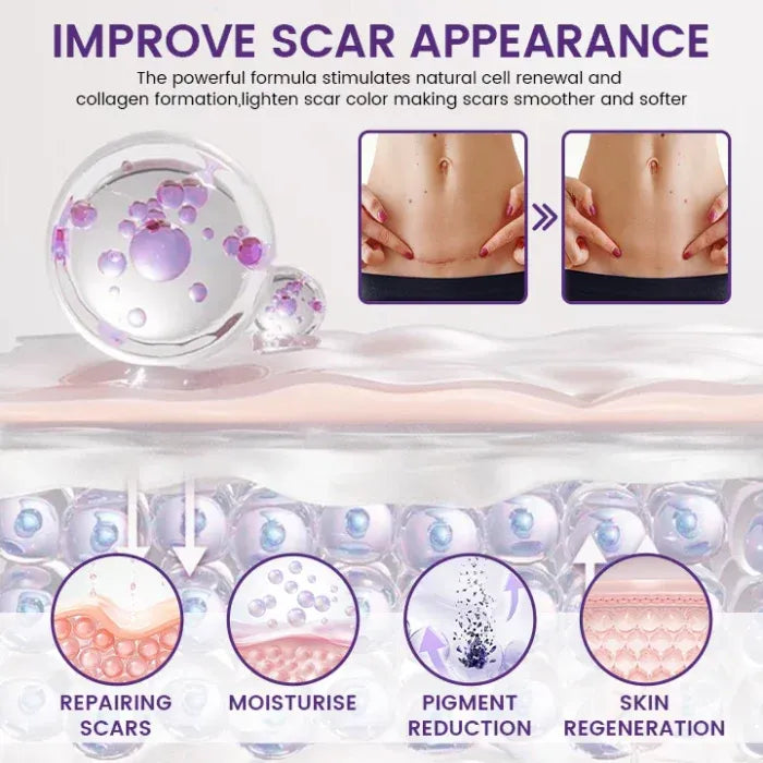 TiMilk – ReGen Scar Stem Cell Repair Gel